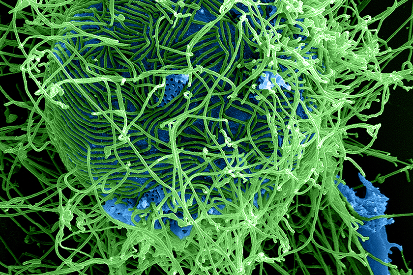 Governo considera “improvável” entrada do ebola no Brasil
