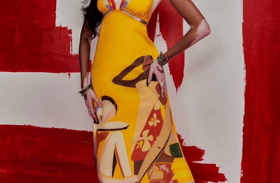 Colcci convida a top model Winnie Harlow para ser musa do Camarote N1, na Sapucaí